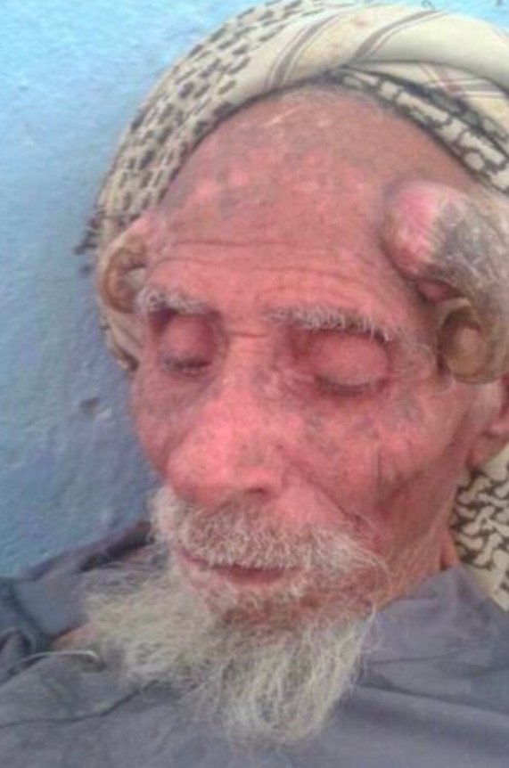  Ali Anter