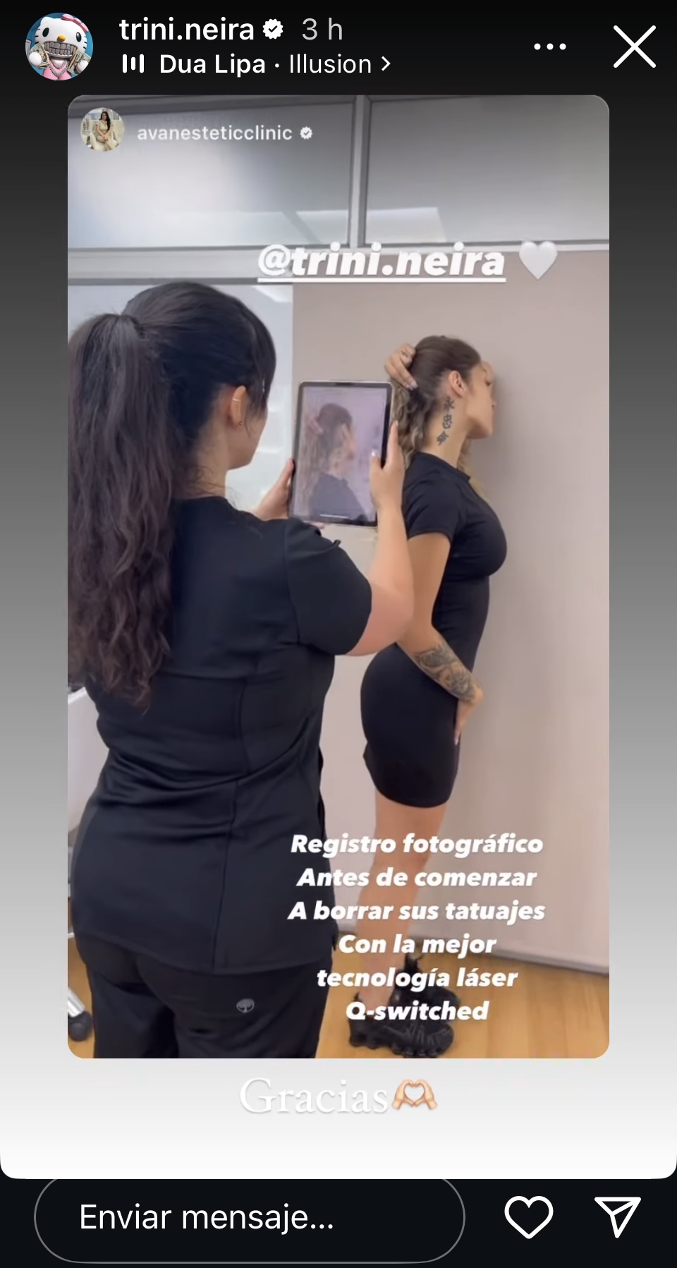 Trini Neira decide borrar algunos de sus tatuajes - Instagram