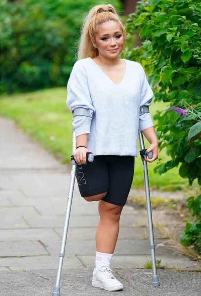 Enfermera perdió pierna por dolor que ignoró durante lucha contra el coronavirus