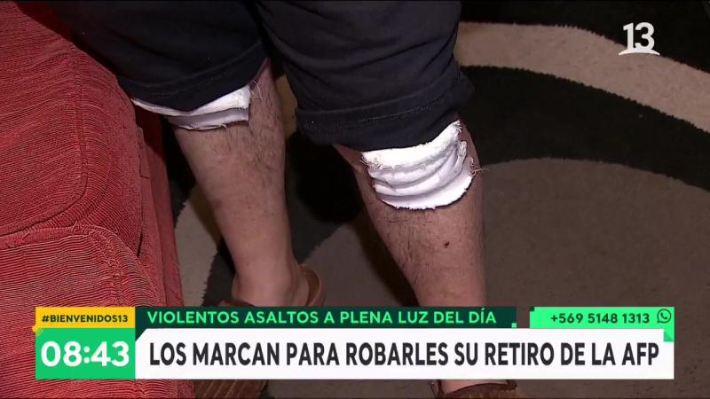 Víctima de las bandas del del 10%