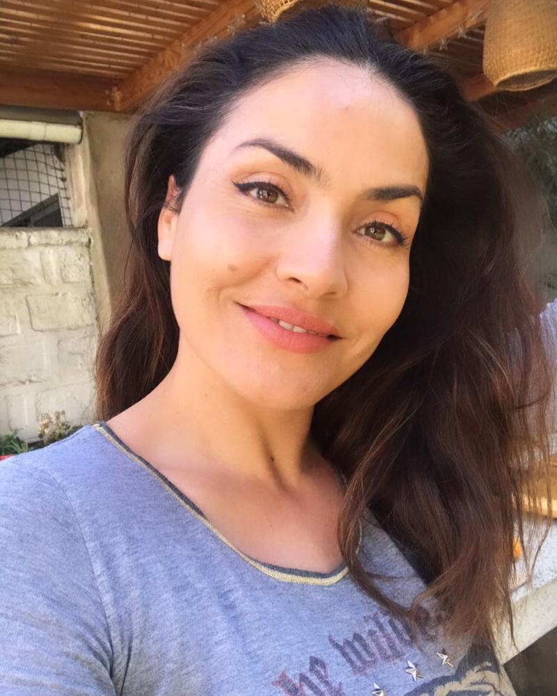 Carmen Gloria Bresky habla de su mala experiencia con el bótox