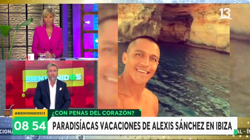 Calugas de Alexis Sánchez generan pregunta indiscreta en “Bienvenidos”