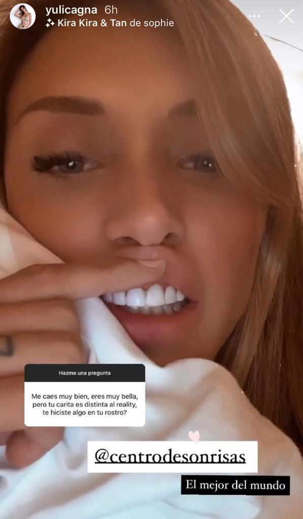 Yuli Cagna enseña sus estrías y cuenta lo que se hizo en el rostro