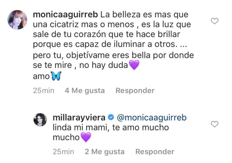 Millaray Viera muestra las cicatrices del acné en su rostro