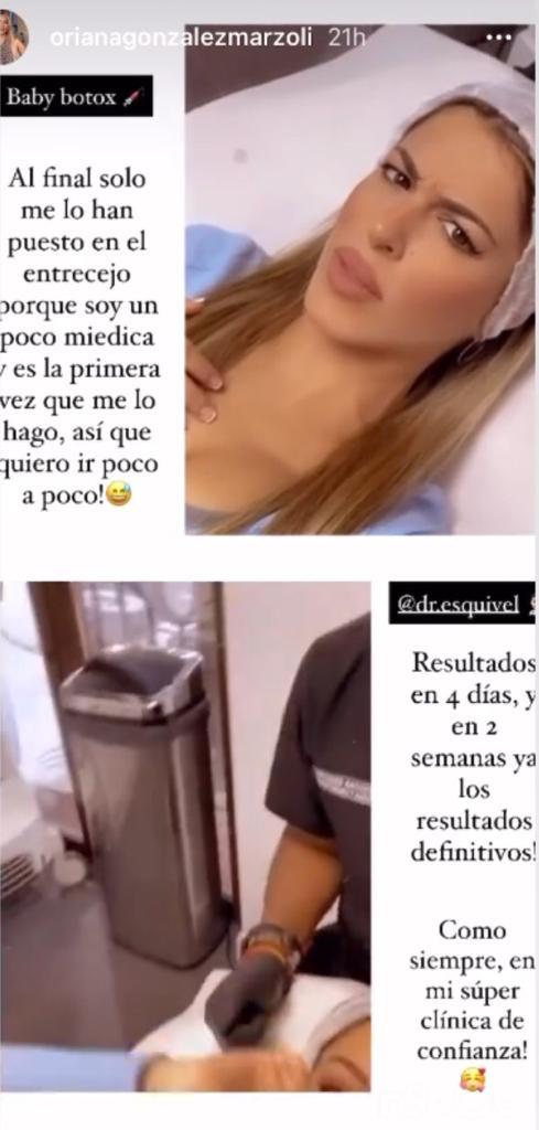 Oriana Marzoli se somete a nueva intervención facial