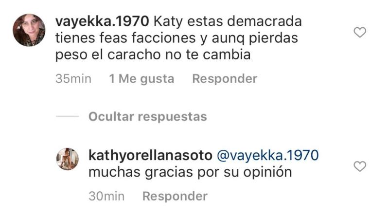 Kathy Orellana responde a crueles mensajes por su rostro
