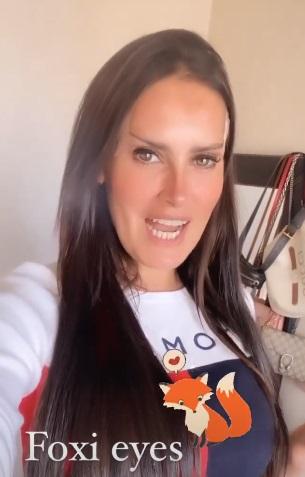 Adriana Barrientos confiesa operación para quedar con “ojos de zorro”