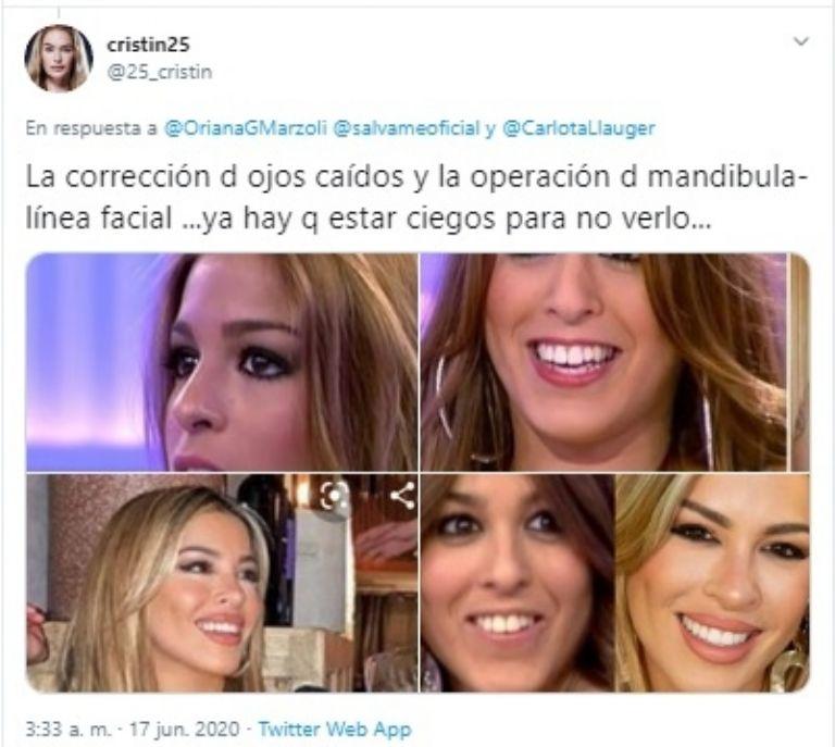 Oriana Marzoli se somete a nueva intervención facial