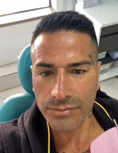 Resultado Kike Acuña