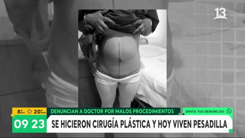 fallida cirugía estética