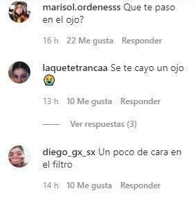 “Se te corrió el ojo”: Ignacia Michelson recibe críticas por curiosa foto