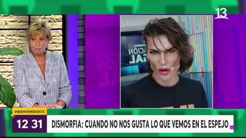 Raquel Argandoña sorprende al hablar de cirugías estéticas