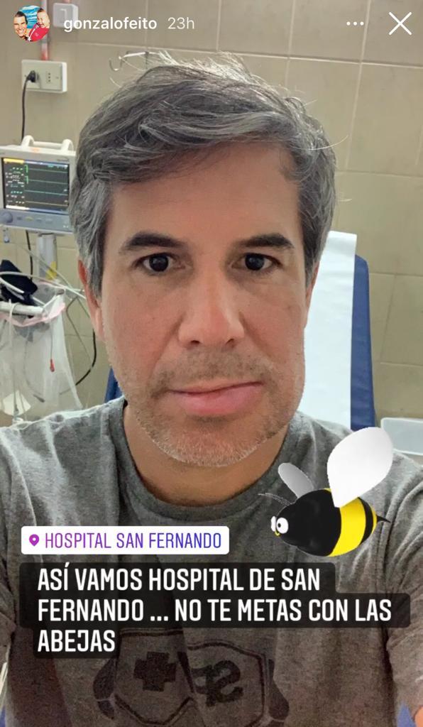 Gonzalo Feito muestra cómo quedó su rostro tras picadura de abeja