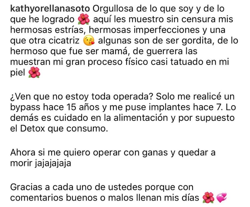 “Orgullosa”: Kathy Orellana muestra sus estrías sin censura