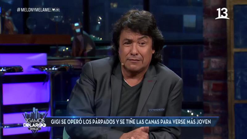 Gigi Martin se operó los párpados y planea nueva cirugía estética