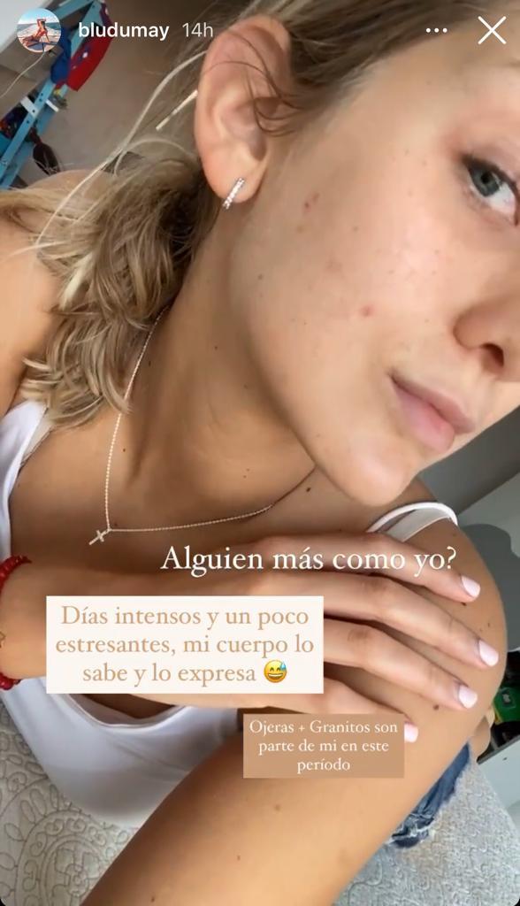 Hija de María Alberó muestra las imperfecciones de su rostro