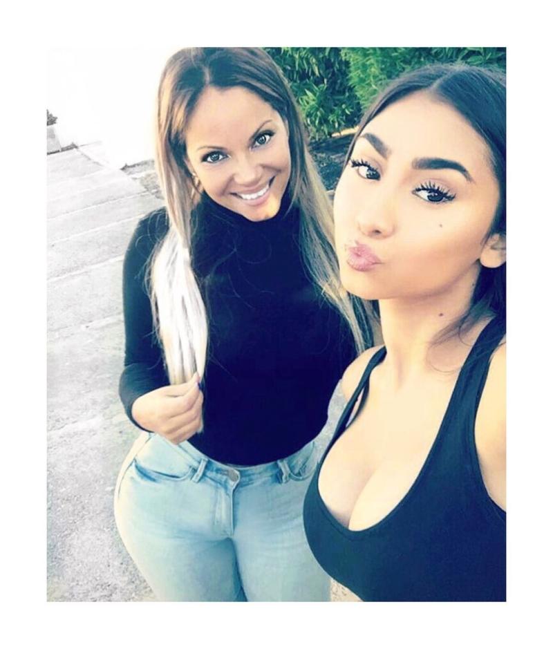 Tía de Paloma Mami confiesa duro drama médico por cirugía estética