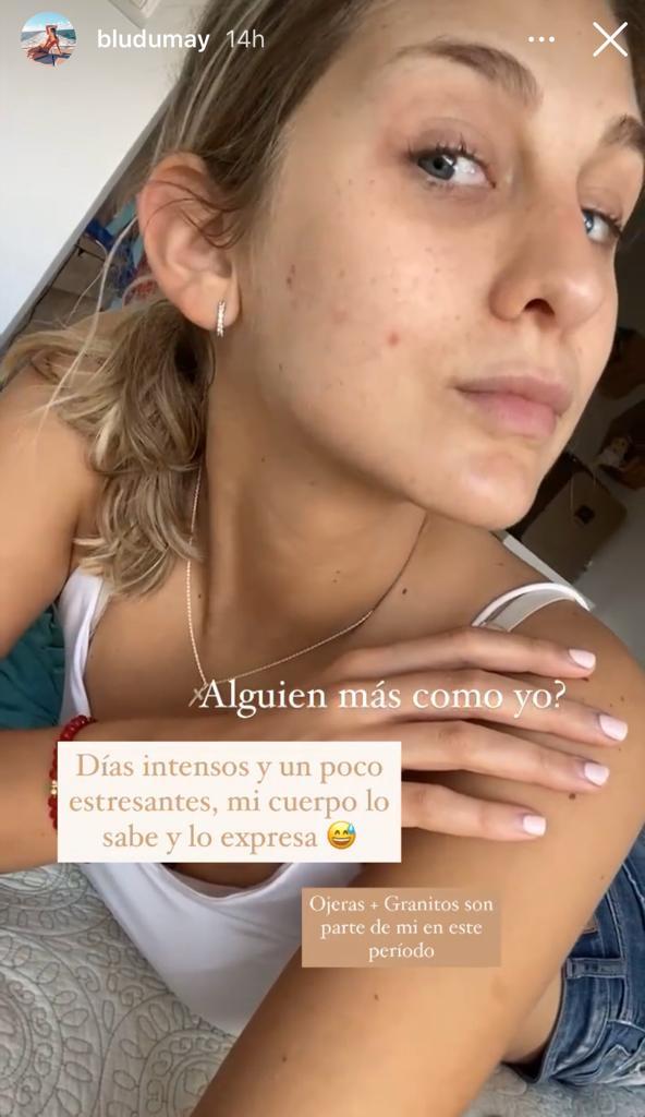 Hija de María Alberó muestra las imperfecciones de su rostro