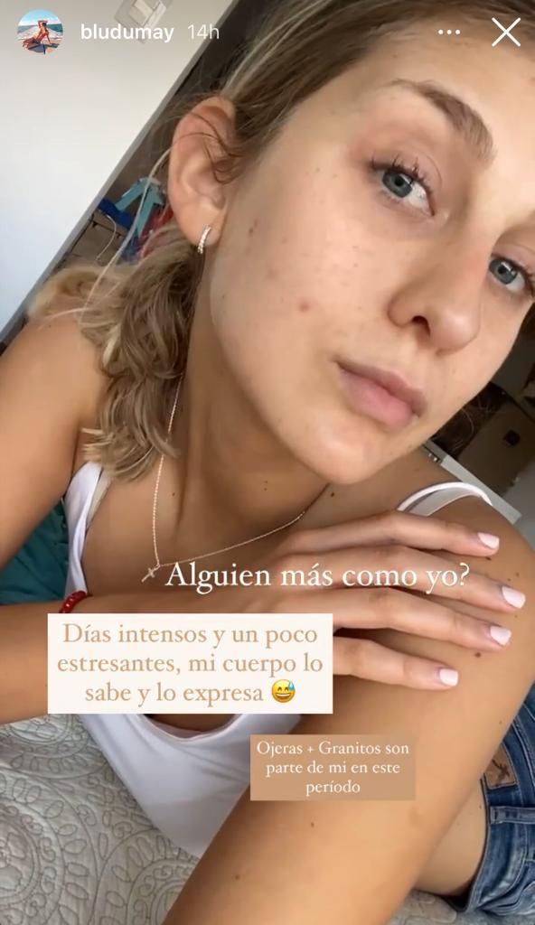 Hija de María Alberó muestra sin filtro las imperfecciones de su rostro
