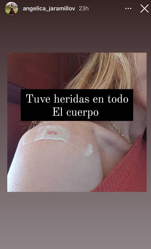 “Un susto”: Ex figura de Mundos Opuestos sufre insólito accidente