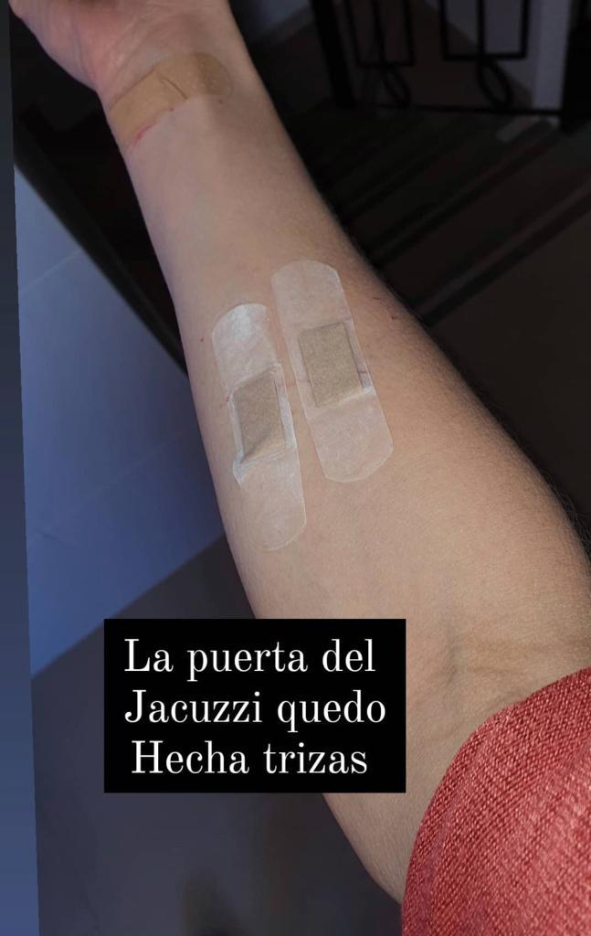 “Un susto”: Ex figura de Mundos Opuestos sufre insólito accidente