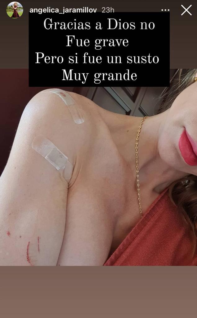 “Un susto”: Ex figura de Mundos Opuestos sufre insólito accidente