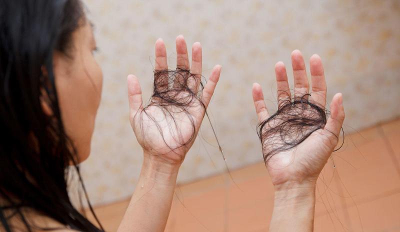 Caída de pelo por coronavirus