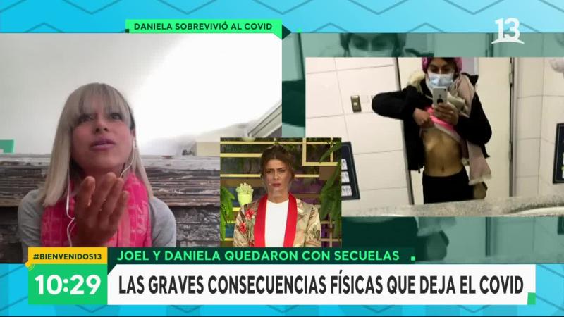 Enfermera quedó con graves secuelas tras contagiarse de covid