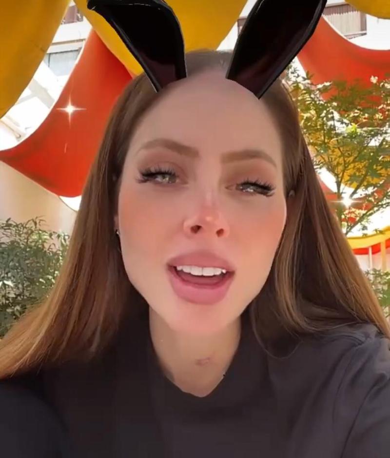 Ignacia Michelson perdió un pedazo de diente en misterioso incidente