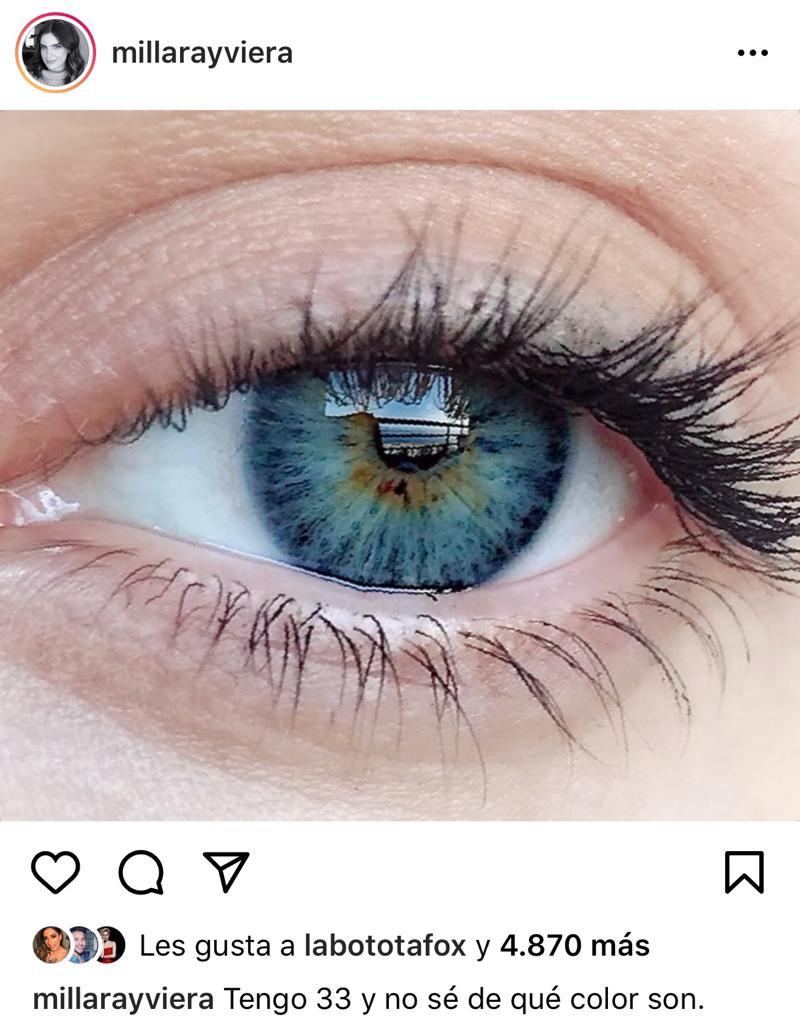 Millaray Viera responde a dura crítica por imagen de sus ojos