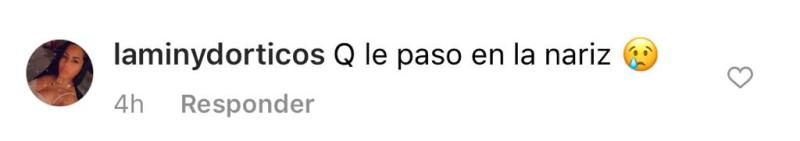 “Qué le pasó a tu nariz”: Fran Undurraga recibe críticas por foto