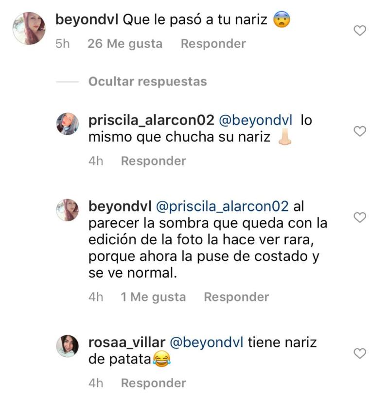 “Qué le pasó a tu nariz”: Fran Undurraga recibe críticas por foto