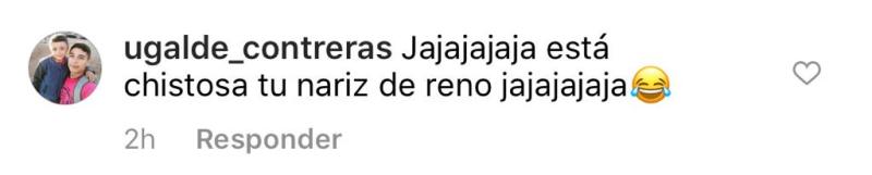 “Qué le pasó a tu nariz”: Fran Undurraga recibe críticas por foto