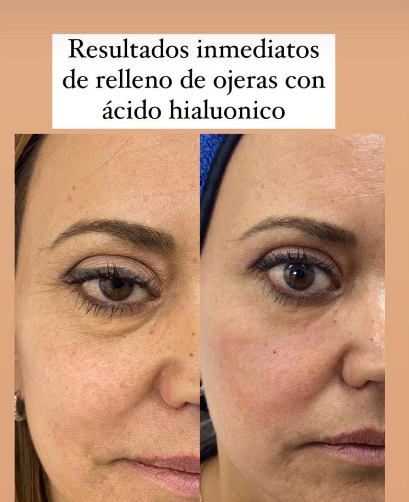 Daniella Campos muestra su rostro tras procedimiento estético