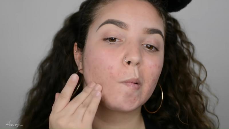 Cubrir el acné con maquillaje