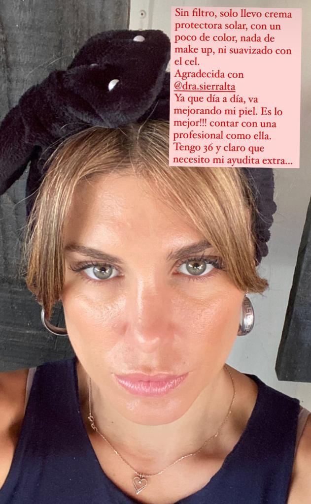 “Sin filtro”: Wilma González enseña su rostro al natural