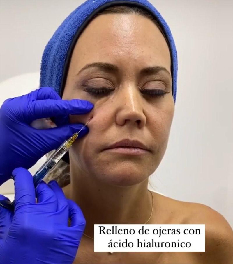 Daniella Campos muestra su rostro tras procedimiento estético