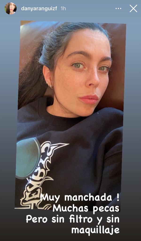 “Muy manchada”: Daniela Aránguiz enseña su rostro sin maquillaje