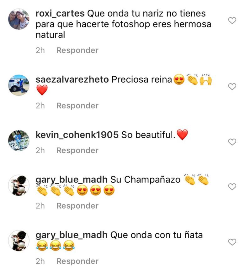 “Qué le pasó a tu nariz”: Fran Undurraga recibe críticas por foto