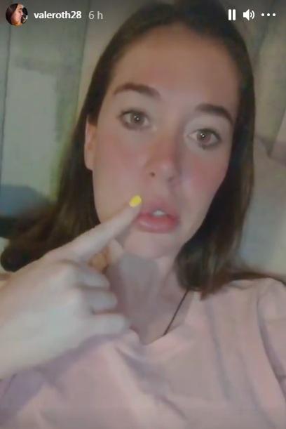 “Me asusté”: Vale Roth sufre parálisis facial tras escándalo