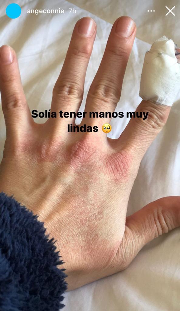 Ángela Duarte sorprende al mostrar sus particulares manos