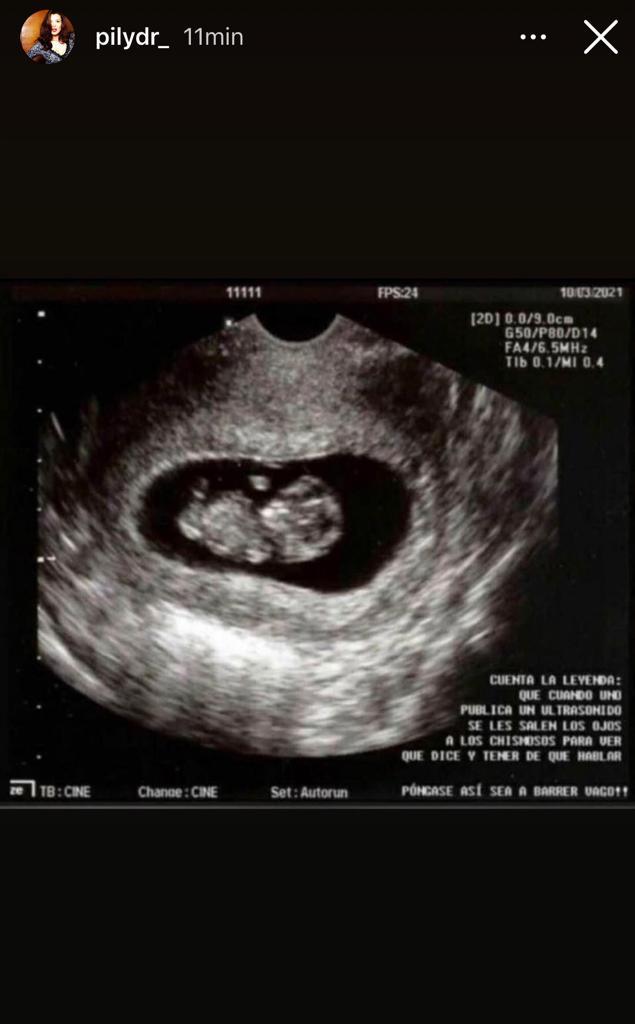 ¿Embarazada o no? Pilar Ruiz desata especulación con foto