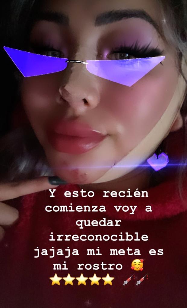 Cambio total: Naya Fácil impacta por retoques en su rostro