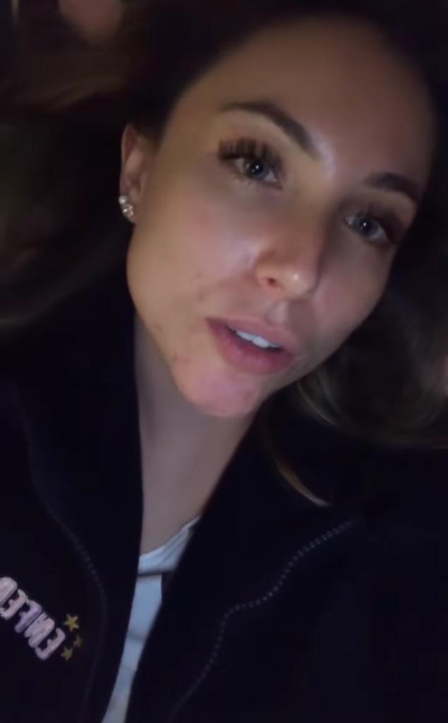 “No sé qué hacer”: Ángela Duarte sufre por los granos en su cara