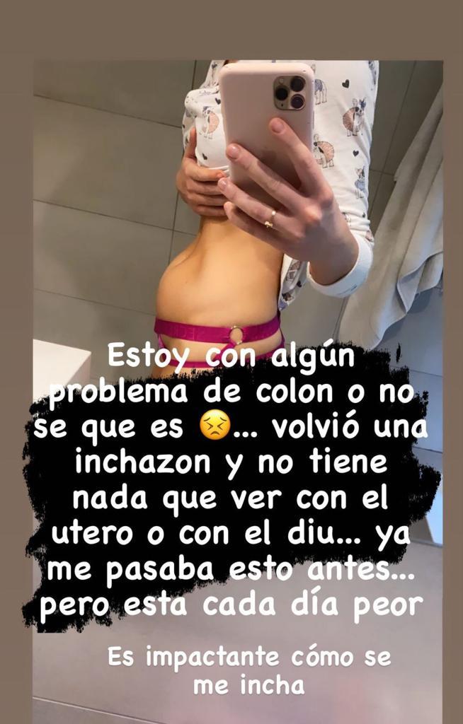 “No sé qué es”: La extraña hinchazón que afecta a Julia Fernandes