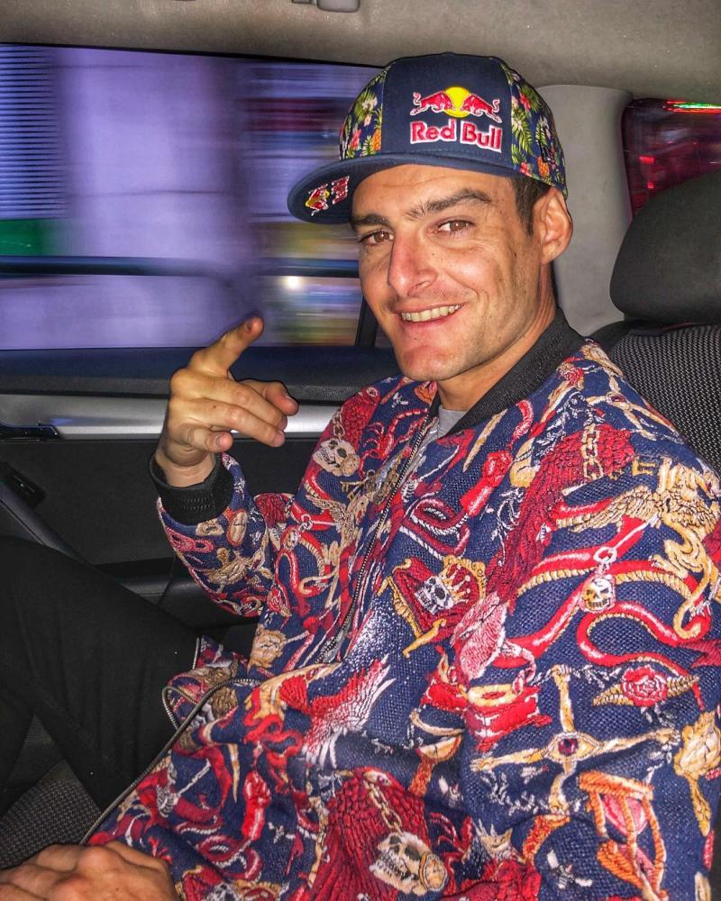 Ignacio Casale se somete a radical cambio de look