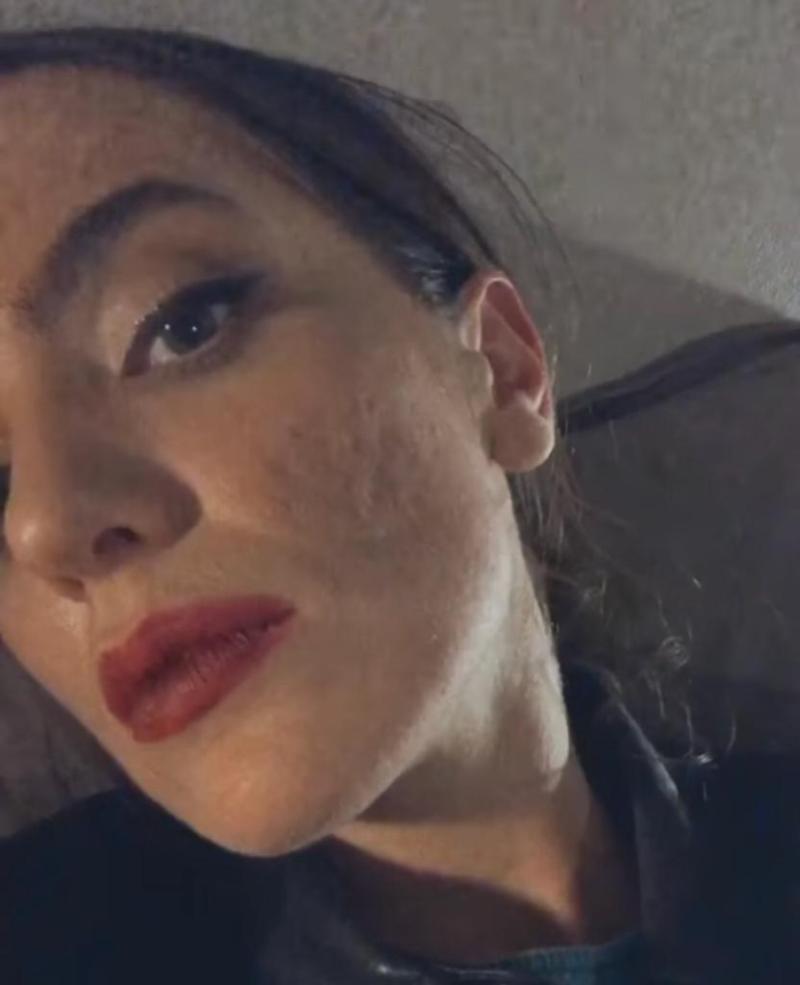 Millaray Viera pide respeto por las pieles imperfectas