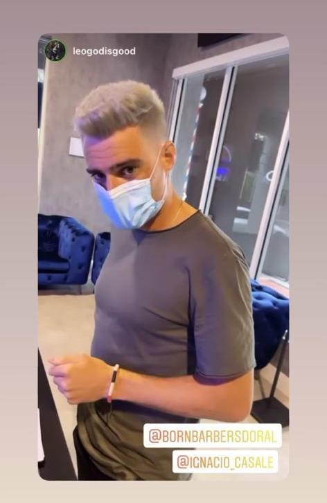 Ignacio Casale se somete a radical cambio de look