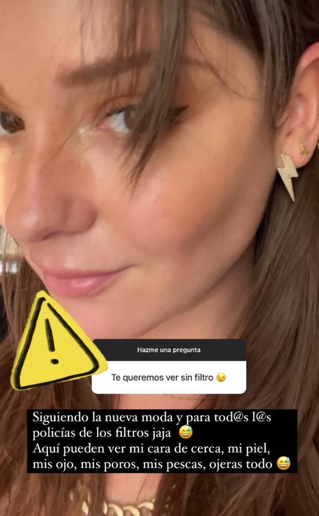 Kel Calderón muestra su rostro sin filtros y revela drama capilar