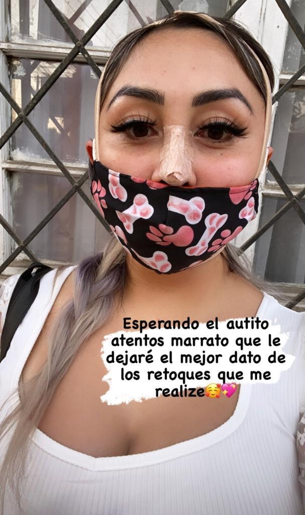 Cambio total: Naya Fácil impacta por retoques en su rostro